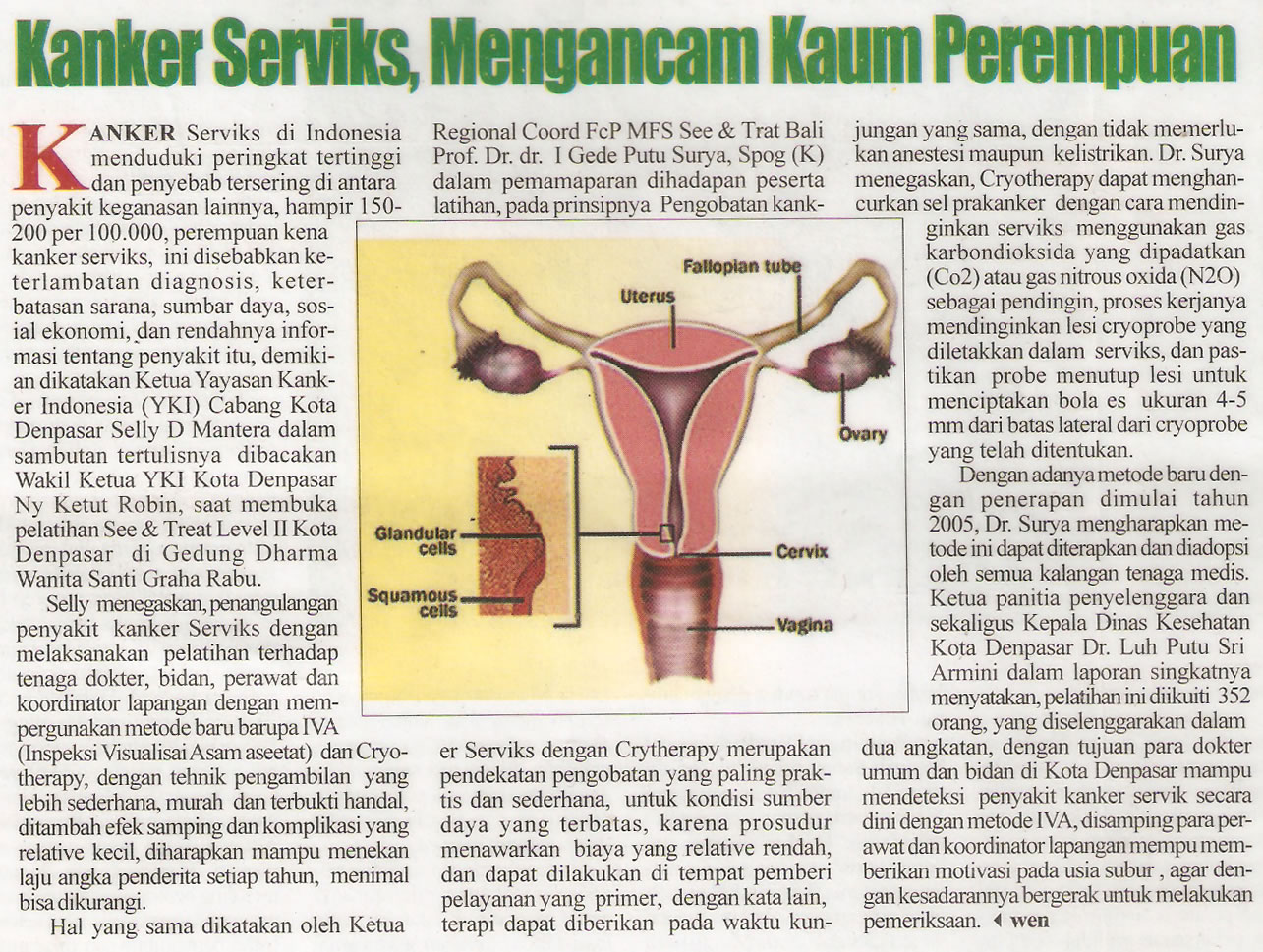 Kanker servik mengancam kaum wanita